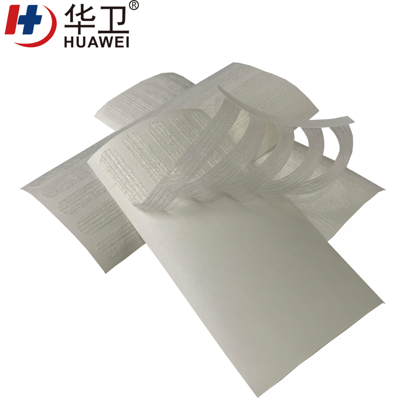 Wound Skin Closure Strip Surgical Tape Wound Closure